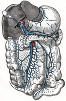 Portal Hypertension